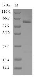 Rat NPR3 Protein (Recombinant 6His-SUMO, N-terminus)