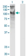 Monoclonal Mouse anti-Human TRPC5 Antibody (clone 1C8, WB)