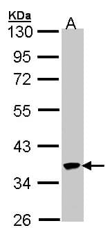 SPOP Antibody