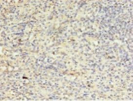 AURKB / Aurora-B Antibody