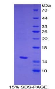 Mouse HPSE / Heparanase Protein (Recombinant His)