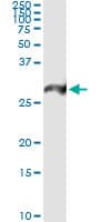 IHC-plus™ Monoclonal Mouse anti-Human PSMA7 Antibody (clone 1A10-3G12, IHC, IF, WB)