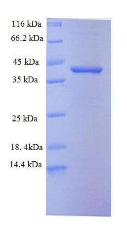Human CDK2AP1 / DOC1 Protein (Recombinant GST)