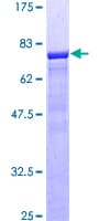 Human NUDC Protein (Recombinant GST)