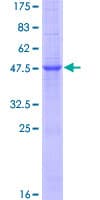 Human IL19 Protein (Recombinant GST)