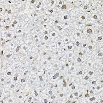 Polyclonal Rabbit anti-Human SMN2 Antibody (IHC, IF, WB)