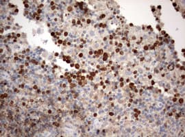 Monoclonal Mouse anti-Human MKI67 / Ki67 Antibody (clone OTI1F11, Carrier-free, aa1160-1493, IHC, WB)