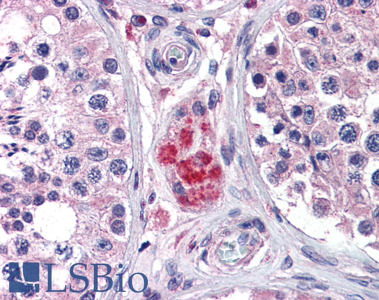 IHC-plus™ Polyclonal Goat anti-Human PPARD / PPAR Delta Antibody (aa430-441, IHC, WB)