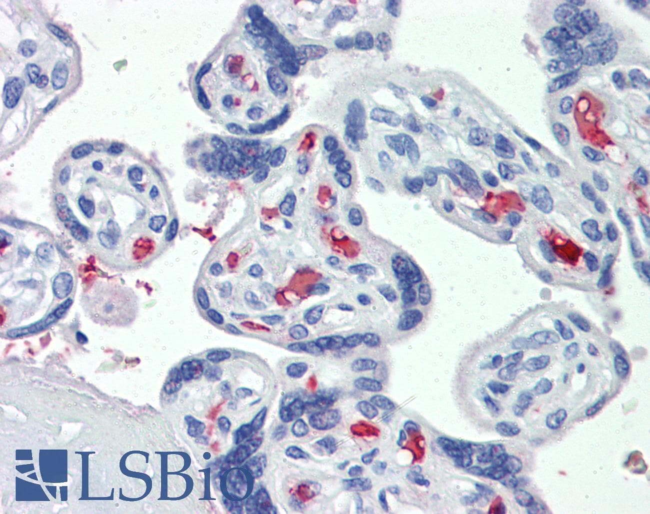 IHC-plus™ Polyclonal Goat anti-Human CLEC2D / OCIL / LLT1 Antibody (aa122-131, IHC, IF, WB)