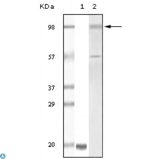 TYRO3 Antibody
