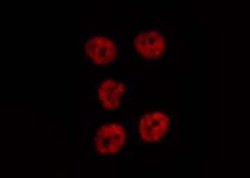 RPS19 / Ribosomal Protein S19 Antibody