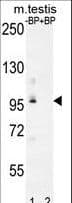 Polyclonal Rabbit anti-Human PDPR Antibody (aa821-850, IHC, WB)