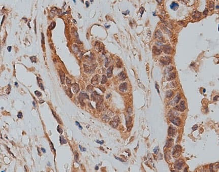SLC25A46 Antibody