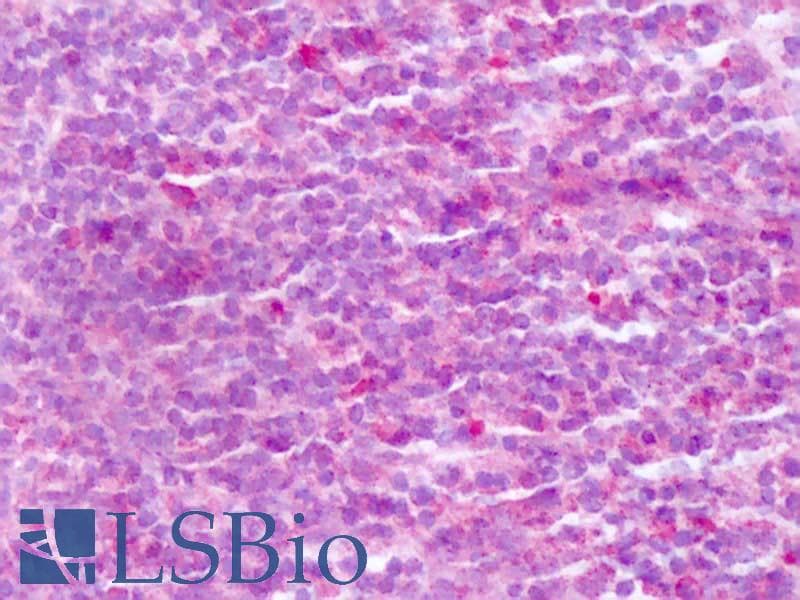 IHC-plus™ ITGA4 / VLA-4 / CD49d Antibody (Internal)