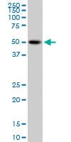 PSTPIP1 Antibody (clone 1D5)