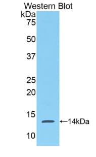 Serum Amyloid A Antibody (aa20-122)