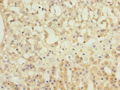 Polyclonal Rabbit anti-Human NME7 Antibody (aa1-150, IHC, WB)