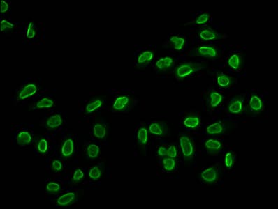 HIST1H2BN Antibody