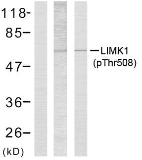 LIMK1 / LIMK Antibody (phospho-Thr508)