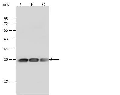 GSTP1 / GST Pi Antibody (clone 003, Preservative Free)