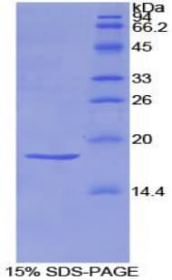Rat SEMA3A / Semaphorin 3A Protein (Recombinant His-T7)
