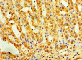 INHBA / Inhibin Beta A Antibody