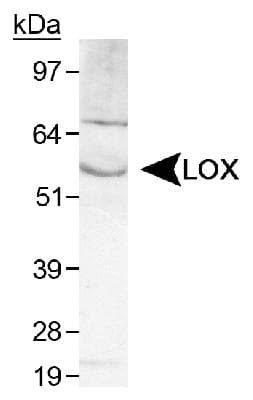 LOX / Lysyl Oxidase Antibody (Internal, Biotin)