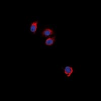EPOR / EPO Receptor Antibody (Internal)