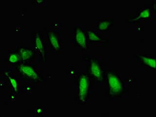 FBXO25 Antibody