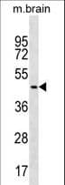 Polyclonal Rabbit anti-Human FAF2 / ETEA Antibody (aa348-377, WB)