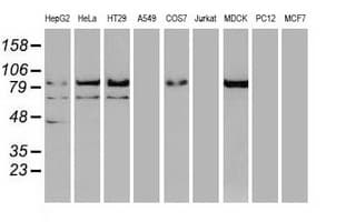 CTNNB1 / Beta Catenin Antibody (clone OTI1F3)