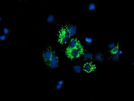 DLD / Diaphorase / E3 Antibody (clone OTI4D5)
