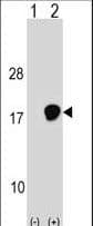 UBE2D3 / UBCH5C Antibody (aa109-136)