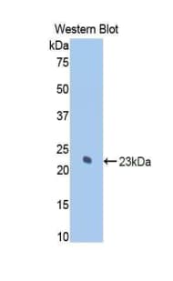 KRT7 / CK7 / Cytokeratin 7 Antibody (aa255-393, Cy3)