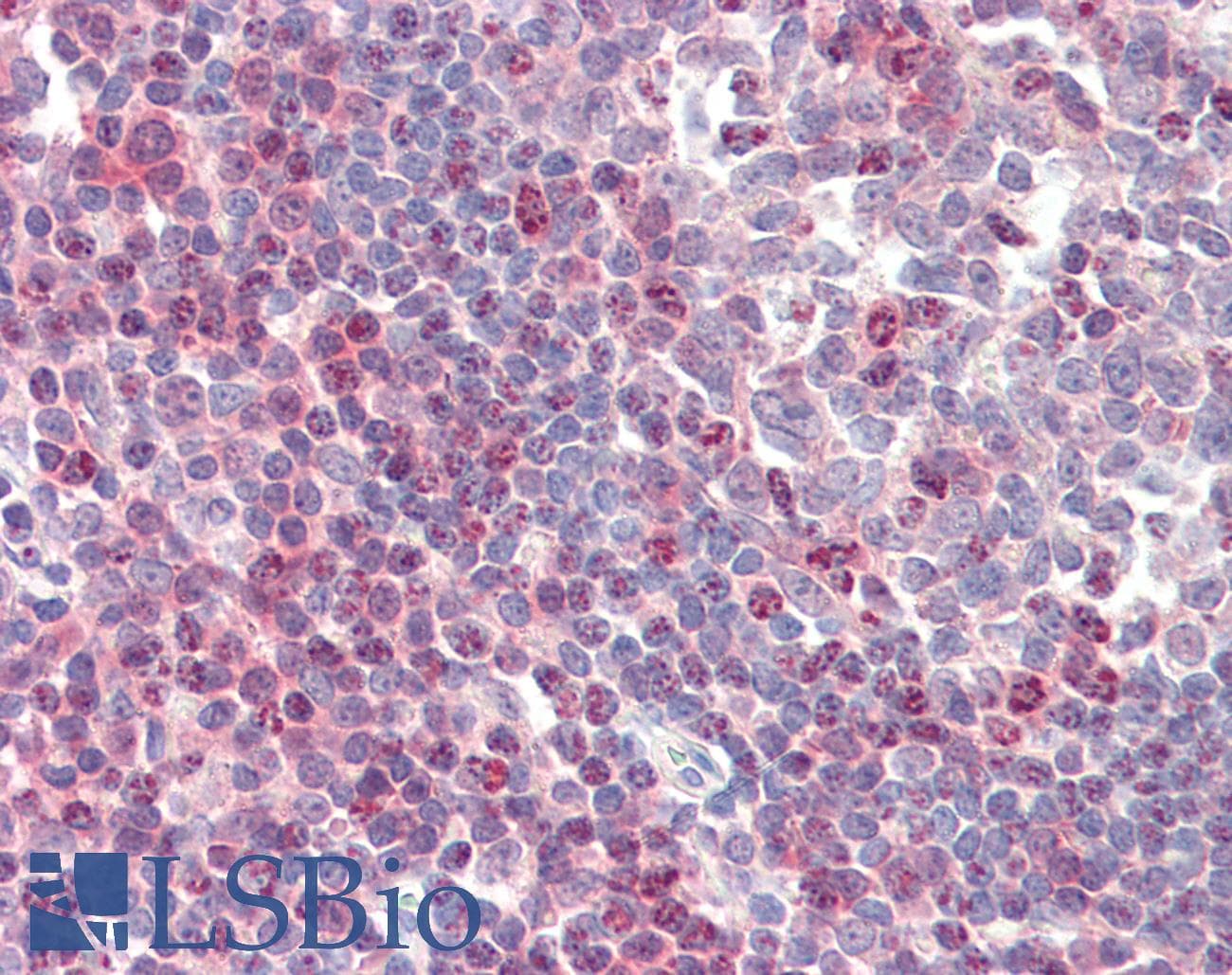 IHC-plus™ ZAP70 Antibody (clone 11H40)