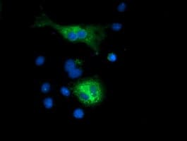 SQSTM1 Antibody (clone OTI5A2)
