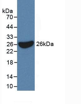 Human IL17RC Protein (Recombinant His, N-Terminal)