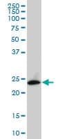 Monoclonal Mouse anti-Human APG5 / ATG5 Antibody (clone 3G11, WB)