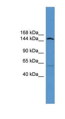 ATP10D Antibody (aa886-935)