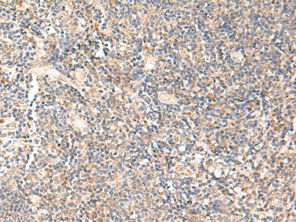 Polyclonal Rabbit anti-Human PPP1R3C / PTG Antibody (IHC)