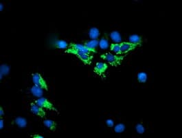 DLD / Diaphorase / E3 Antibody (clone OTI6D5)
