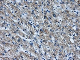 AKR1A1 Antibody (clone OTI8E12)