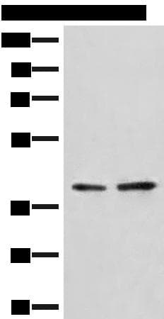 Polyclonal Rabbit anti-Human HNRNPA3 / HnRNP A3 Antibody (IHC, WB)