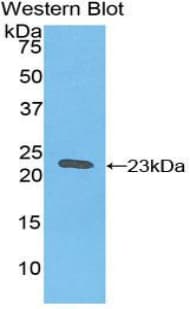 HBB / Hemoglobin Beta Antibody (aa1-147)