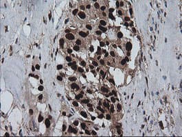 ZSCAN18 / ZNF447 Antibody (clone OTI4F12)