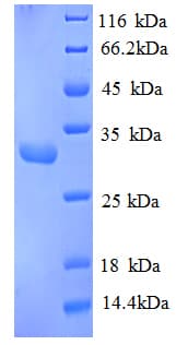 Human RPA4 Protein (Recombinant His)