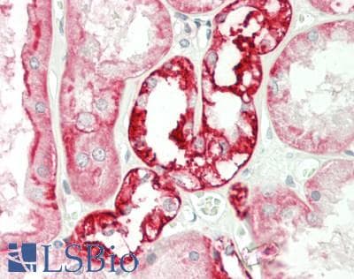IHC-plus™ ATP1A1 Antibody