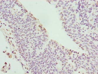 Polyclonal Rabbit anti-Human C17orf62 Antibody (IHC, WB)