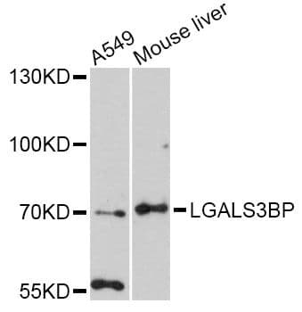 MAC-2-BP / LGALS3BP Antibody