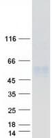 Human CD177 Protein (Recombinant Myc-DDK (Flag))